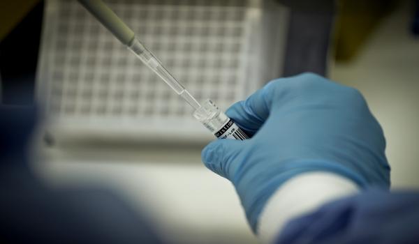 Brasil investiga quatro casos suspeitos de gripe aviária em humanos