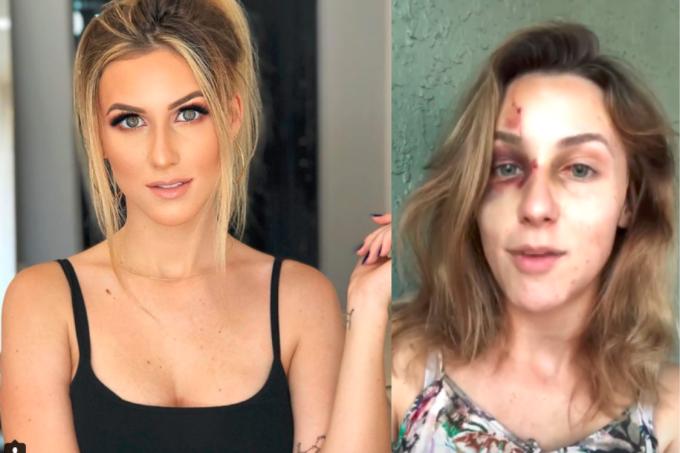 Brasileiro preso por agressão a namorada nos EUA é solto