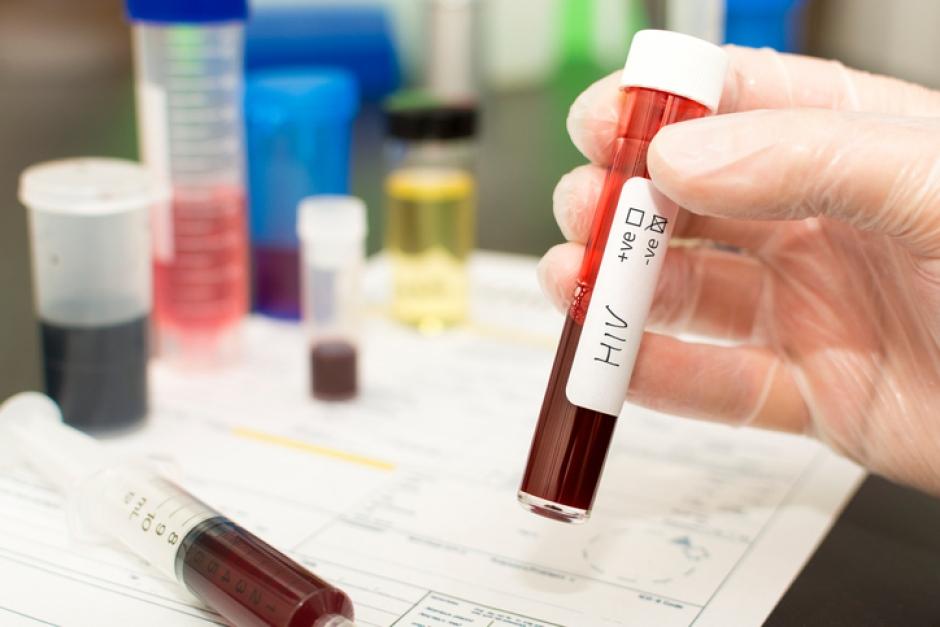 Laboratório é condenado a indenizar paciente em R$ 20 mil por resultado errado de teste de HIV