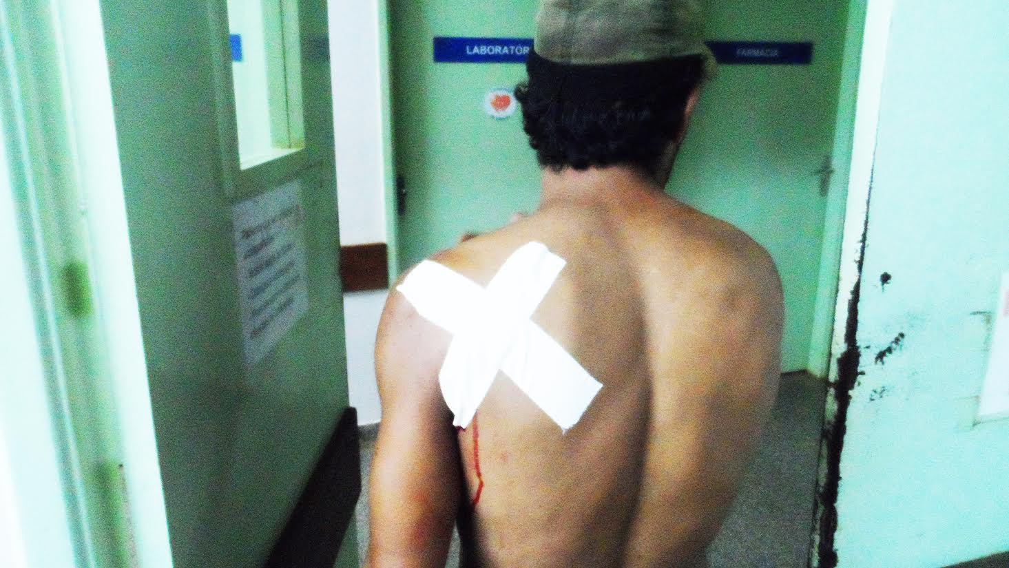 Homem invade casa e fere 6 da mesma família