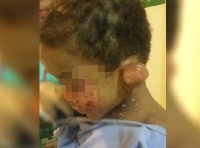 Conselho Tutelar diz que ficou 60 dias sem ver garoto torturado porque tia 'fugia'