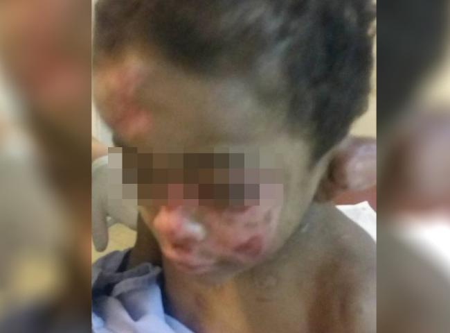 Menino torturado tem alta prevista para daqui uma semana