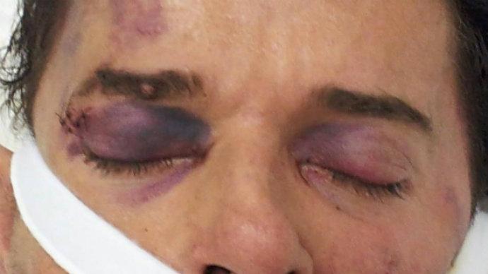 Brasil gasta R$ 5 bi por ano com vítimas de violência