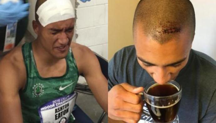 Campeão olímpico é atingido por vara e leva seis pontos na cabeça