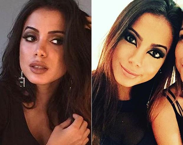 ‘Minha boca virou assunto nacional’, diz Anitta