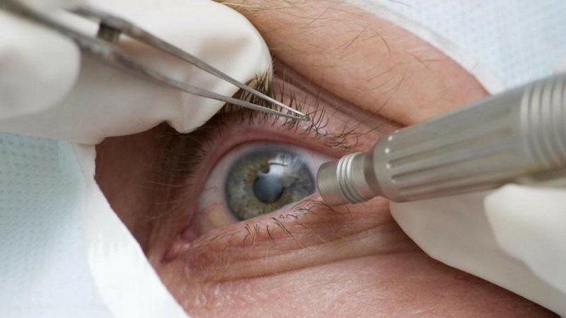 Pandemia causa queda de 27 milhões de procedimentos de saúde em 2020