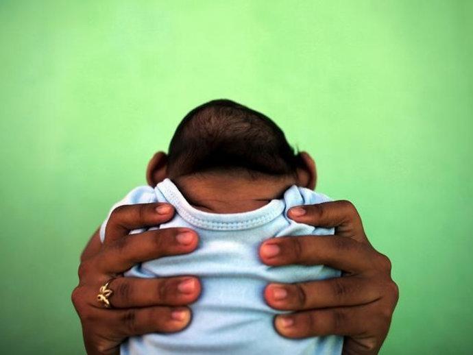 Zika pode reduzir desenvolvimento do cérebro em até 40%, diz pesquisa