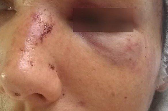 Ao se negar a fazer sexo com marido, mulher é espancada a socos e arrastada pelos cabelos