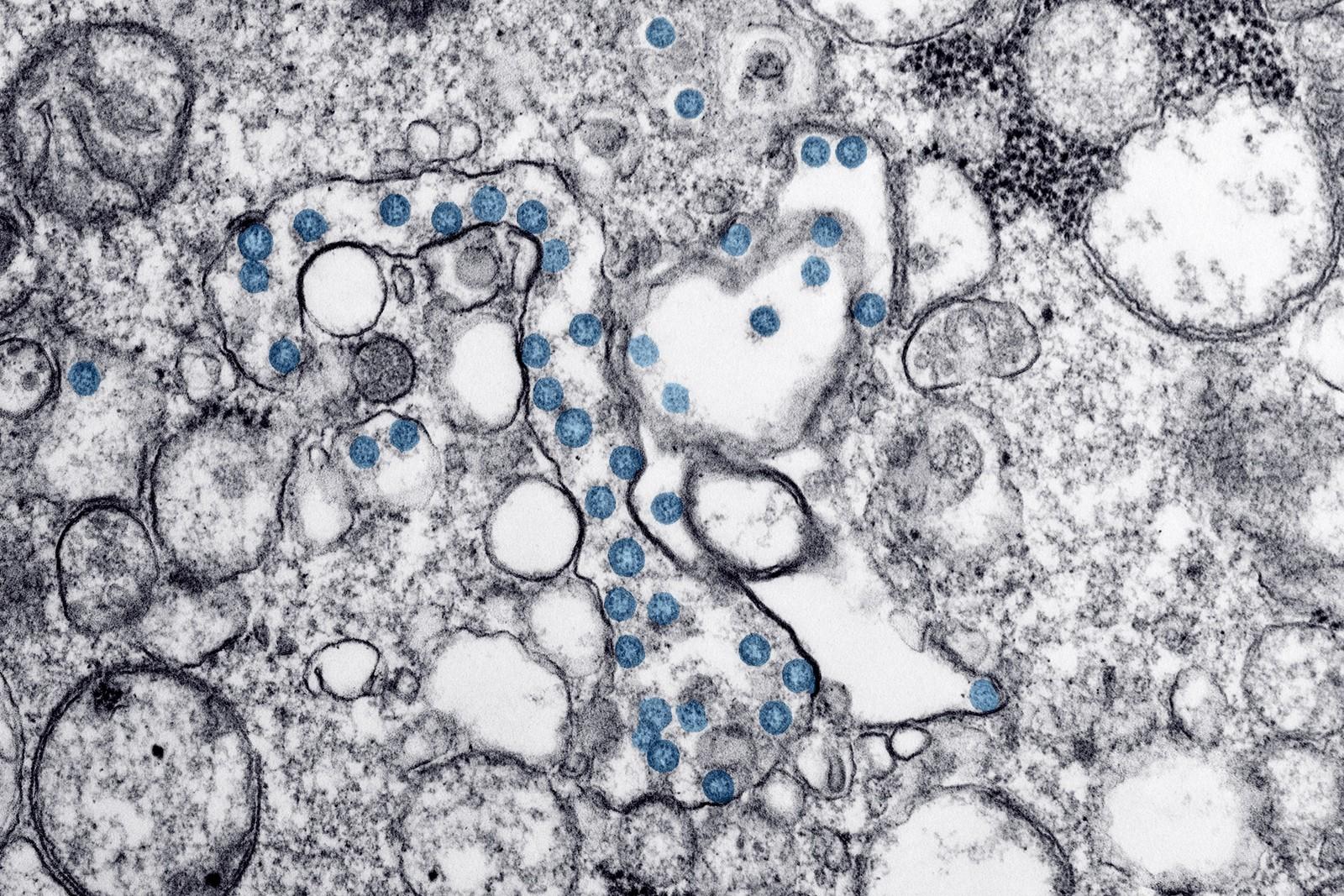 Covid-19 se espalhou mais devagar do que o H1N1