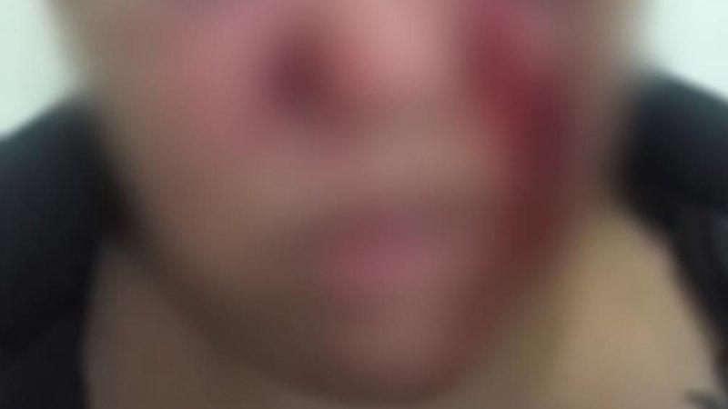 Mulher se recusa a desbloquear celular para marido e acaba esfaqueada com canivete