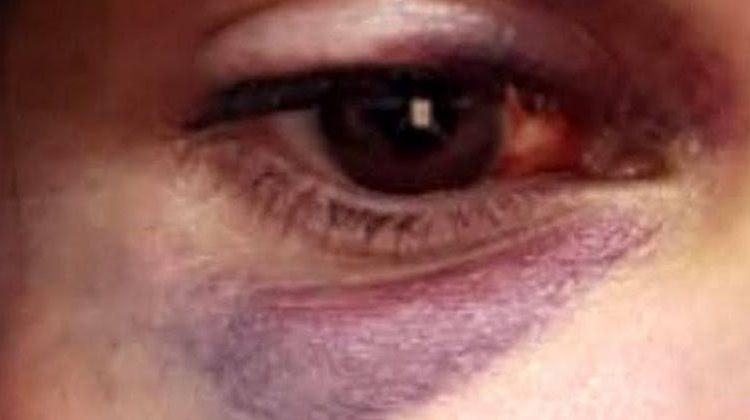 Marido é preso após agredir e tentar jogar óleo quente em mulher