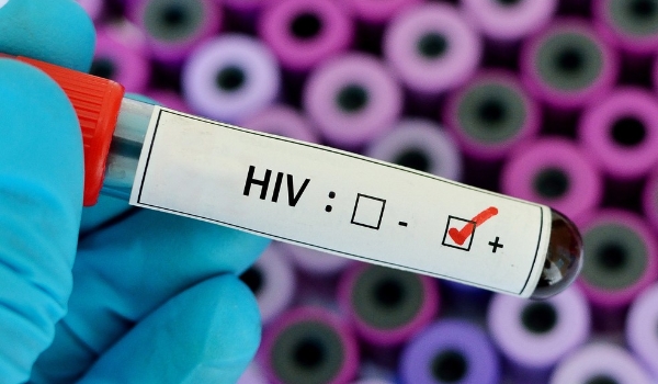 Teste em macacos de vacina de RNA mensageiro contra a Aids mostra 79% de redução do risco de infecção
