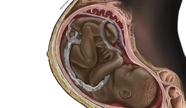 Ilustração de mãe e feto negros viraliza: conheça o estudante de medicina da Nigéria por trás do desenho