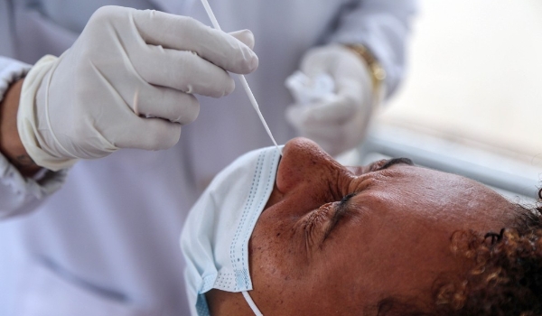 Há risco de falta de testes para Covid no Brasil, alerta associação de laboratórios