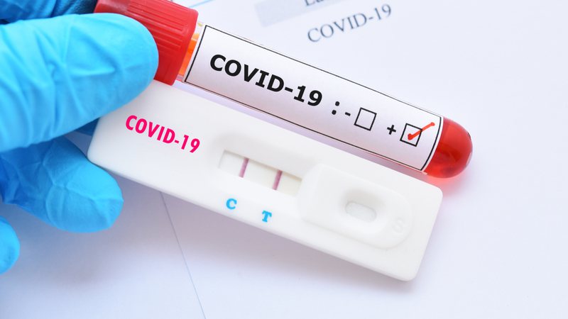 Estou com covid, e agora? Confira orientações trabalhistas para quem testou positivo