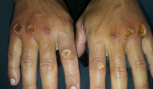 Sindicato denuncia abusos e agressões em curso para policiais penais de Minas