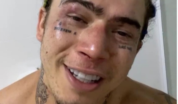 Whindersson mostra rosto castigado por Popó em luta: 