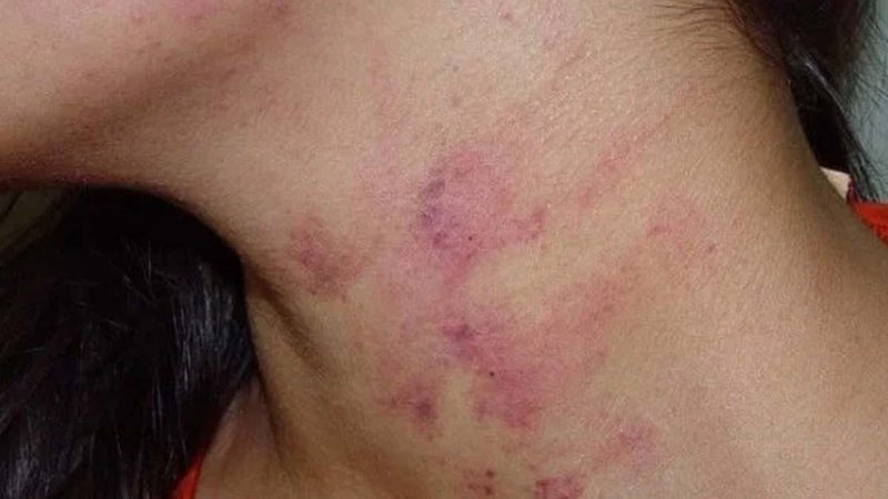 ‘Olha para mim quando falo com você’, namorado espanca mulher ao descobrir entrevista de emprego