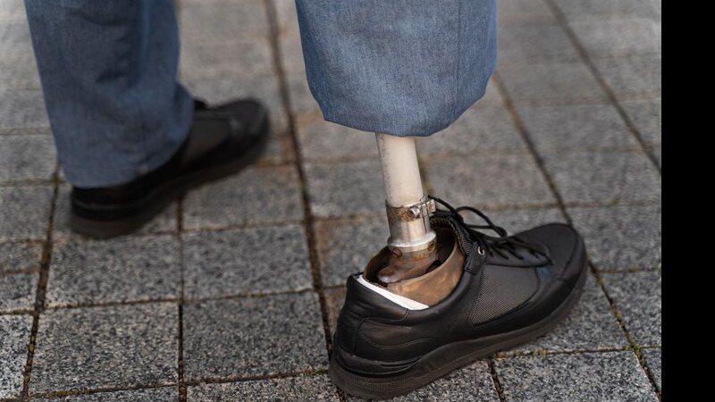 Projeto quer obrigatoriedade de cartaz em unidades de saúde sobre gratuidade de próteses