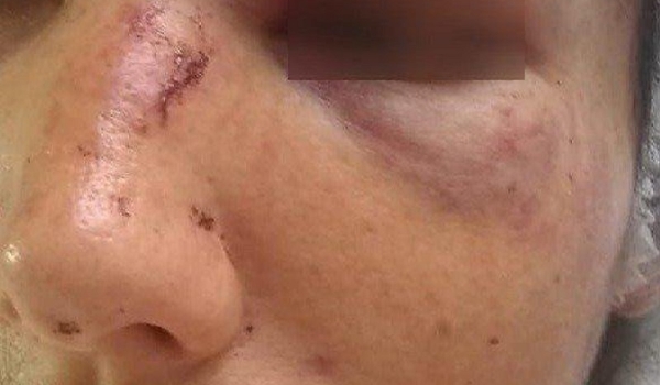 Vizinhos ouvem gritos e polícia encontra mulher esfaqueada por idoso