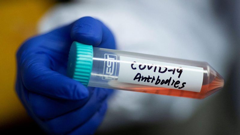 Brasil registra 518 mortes e 78.374 casos de covid nas últimas 24 horas