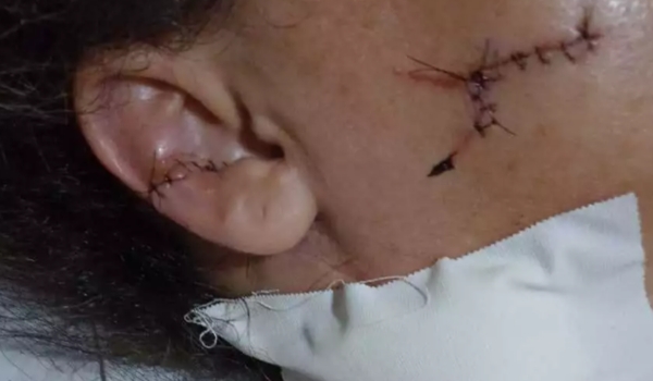 “Foi horroroso, desesperador”, diz motorista de aplicativo esfaqueada 15 vezes