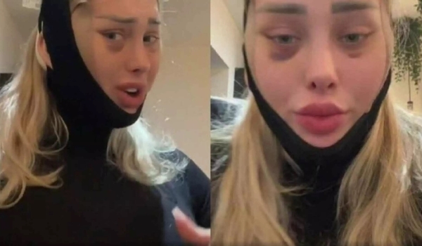 Cabeça de influencer ‘explode’ durante voo e deixa internautas chocados