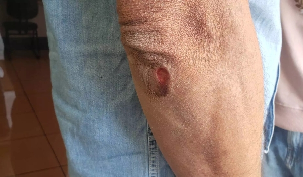 ‘Achei que iam me matar’, diz motorista de aplicativo vítima de roubo em Campo Grande