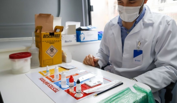 HIV: especialistas destacam importância do acompanhamento psicológico no diagnóstico