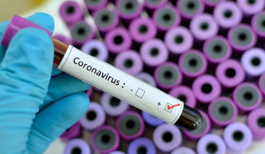 Estado confirma mais 3 mortes por coronavírus em MS
