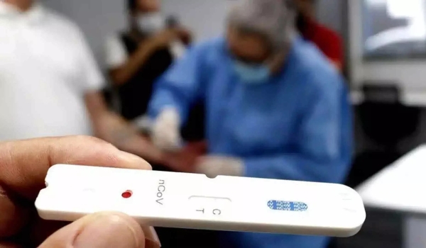 Sintomas da covid-19? Confira quais unidades fazem o teste em Campo Grande