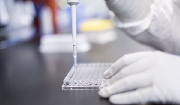 Estudo identifica fator genético que pode levar à proteção contra a Covid-19