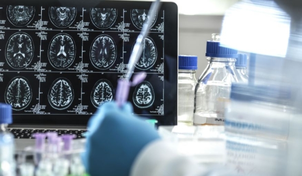 Proteína com ação antienvelhecimento combate inflamação e evita morte de neurônios