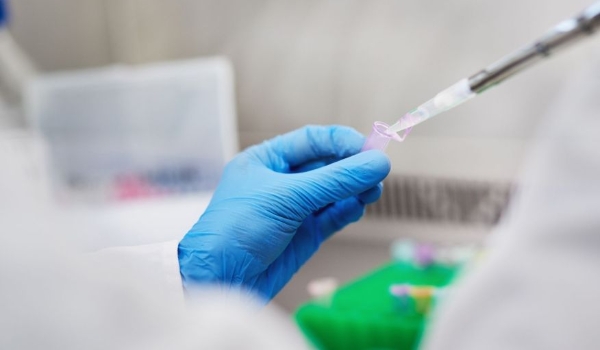Butantan desenvolve terapia celular em linfoma e leucemia; ensaio clínico deve começar em 2023