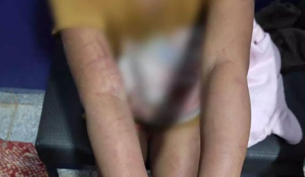 Justiça decreta prisão preventiva de mãe e padrasto que torturaram crianças