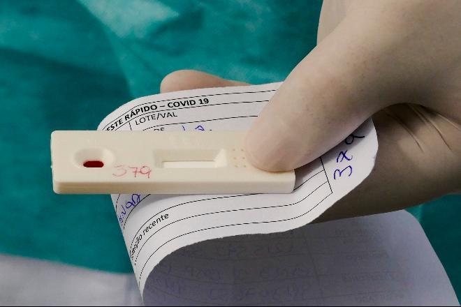 MS ultrapassa os 10 mil casos da Covid-19