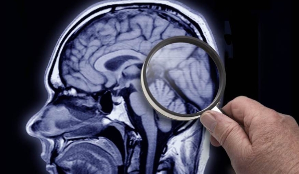 Síndrome de Tourette: veja as causas e sintomas para a doença marcada por tiques