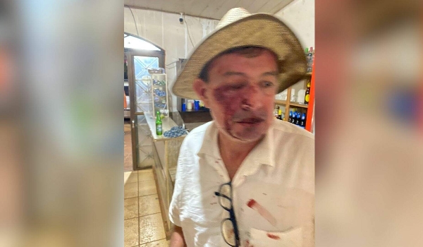 Vereador troca socos com comerciante durante briga em conveniência