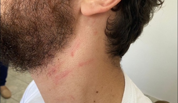 PF investiga delegado que agrediu professor do filho em escola no Paraná 