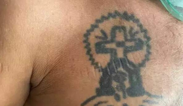 Morre idoso espancado e encontrado pela família em hospital através de tatuagem