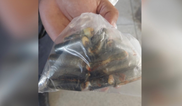 Boliviano passa por cirurgia para retirar 20 cápsulas de cocaína do estômago