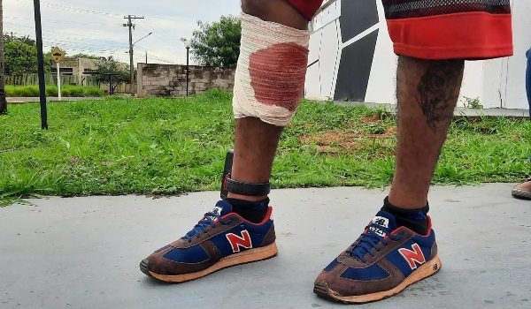 Após ouvir barulho de tiro, homem sai de casa e é atingido