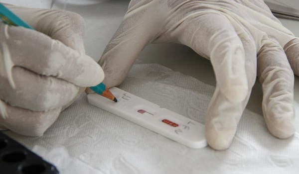 MS registra 275 novos casos de covid na primeira semana epidemiológica do ano