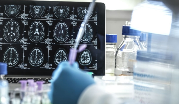 Casos de demência podem ser causados por doença no fígado, mostra estudo