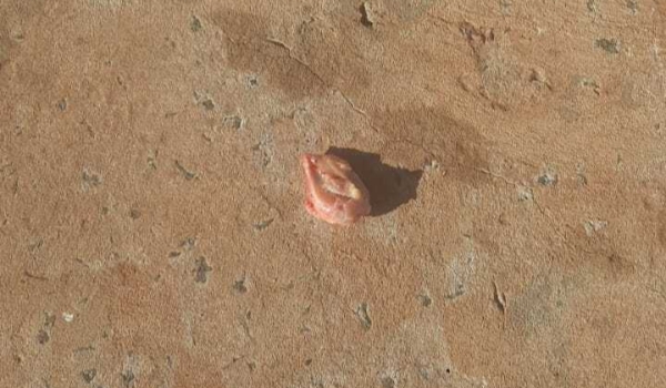 Mulher tem fratura exposta e osso vai parar no asfalto após acidente