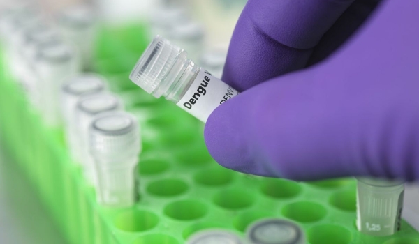 Combo de vírus: como diferenciar dengue, Covid, influenza e rotavírus?