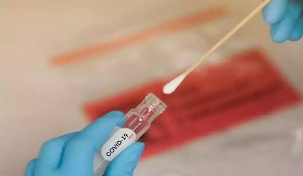 Em semana sem mortes, MS bate 9 mil casos confirmados de covid-19