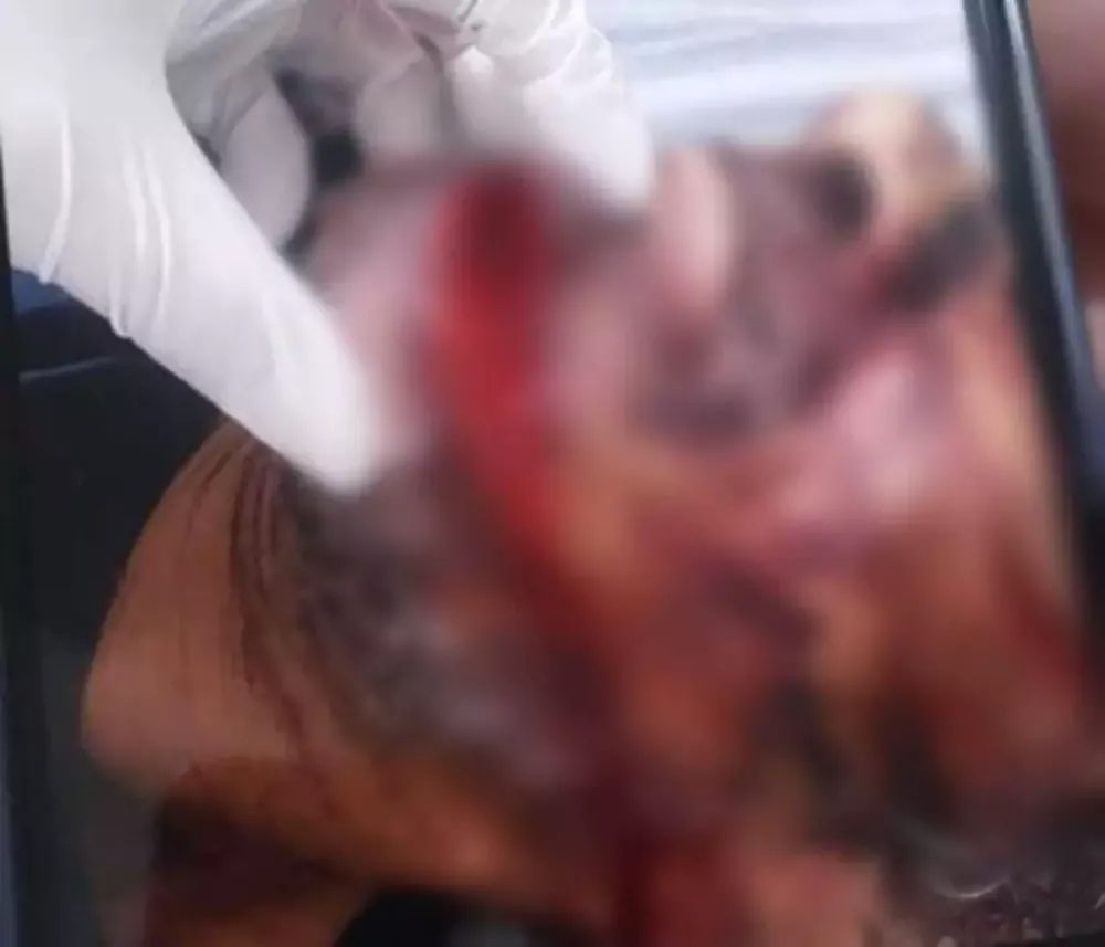 Homem é esfaqueado pela esposa, tem mão amputada e cabeça aberta 