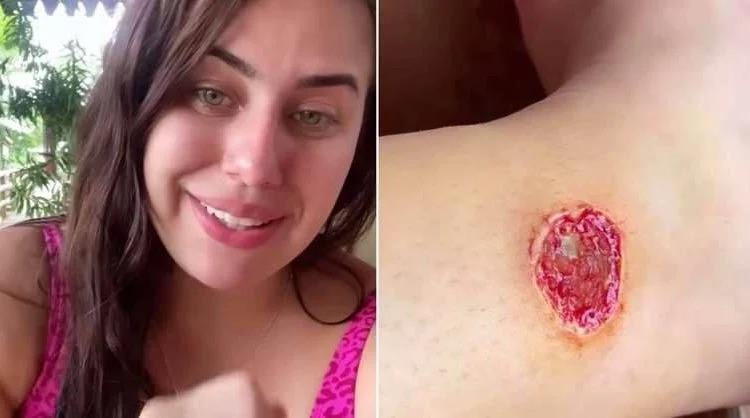 Blogueira de MS é mordida por piranha durante viagem ao Pantanal