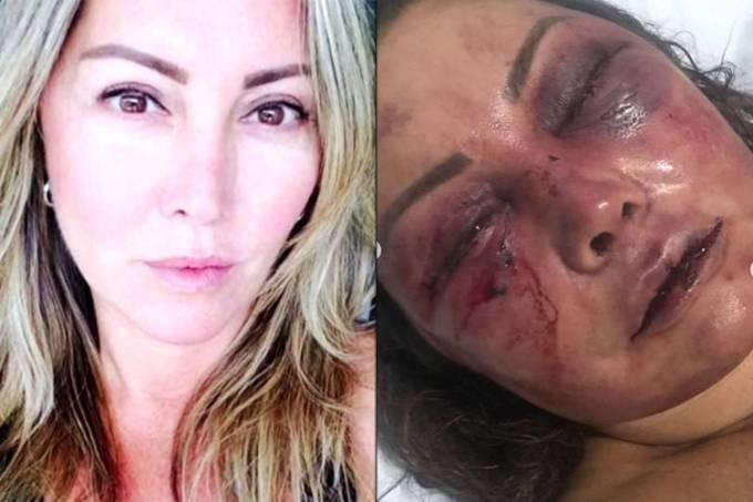 Mulher espancada por 4h no Rio diz ter certeza que agressor a dopou